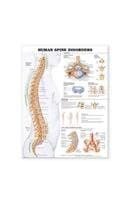 Human Spine Disorders Anatomical Chart