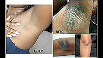 Plymun 3Pcs Snow Bleach Cream for Private Part, Intimate Areas-Underarm, Neck, Armpit, Knees, Elbows, Dark Spot Remover Cream