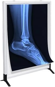 X-ray Film Illumination Light Box, Wall-Mounted LED X-Ray Film Illumination View Box with Natural Soft Light