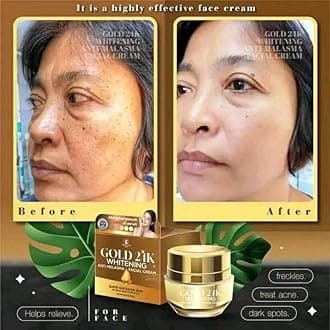 Gold 24k Whitening Anti-Melasma Facial Cream with anti- melasma soap 15g
