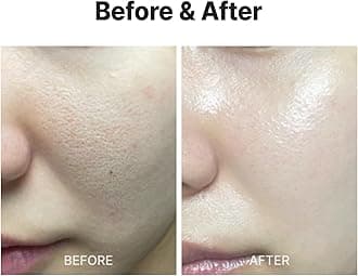 MEDITHERAPY Wrinkle fit Korean Mesh Sheet Masks (7EA), Collagen Mesh Sheet Mask for Glowing Skin, Daily Facial Mask, Hyaluronic acid Facial Mask, Korean Skincare