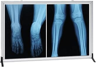 X-ray Film Illumination Light Box, Wall-Mounted LED X-Ray Film Illumination View Box with Natural Soft Light
