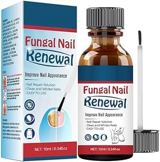 Nail Repair Essnce Liquid, Fingernail and Toenail Repair, Fix & Renew Damaged, Broken, Cracked & Discolored Nails, Reduce Nail Thickening, Strengthen Nails for Beautiful Nail