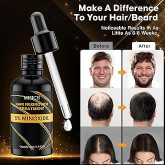 Minoxidil for Men and Women Hair Growth, 5% Minoxidil for Men Beard Growth,Hair Regrowth Treatment for Thinning Hair and Hair Loss (50ML)